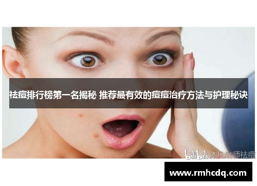 祛痘排行榜第一名揭秘 推荐最有效的痘痘治疗方法与护理秘诀